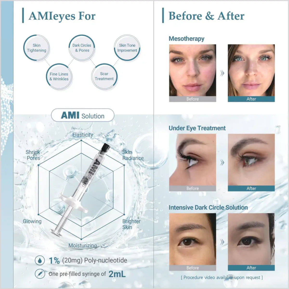 AMIeyes solution promotional image showcasing its benefits for skin tightening, dark circles, wrinkles, scars, and skin tone improvement. Includes a syringe graphic and before-and-after images for mesotherapy, under-eye treatment, and dark circle reduction.