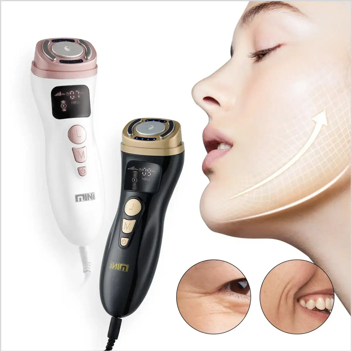 Mini-Hifu Anti Wrinkle Device for Skin Tightening Skin - Shopngo.pk