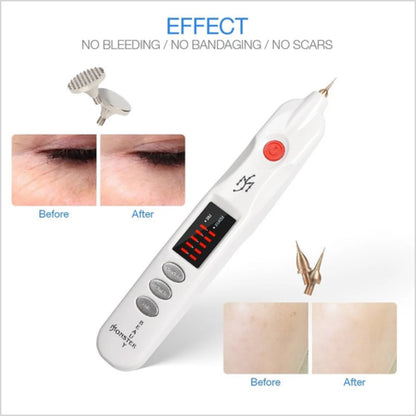 Advanced Beauty Monster Plasma Pen For Stretch Marks